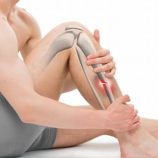 Complex Fractures and Trauma Care