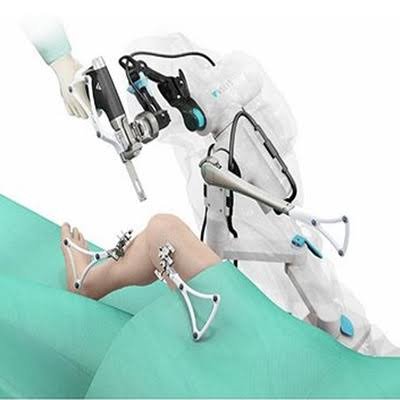 Robotic Total Knee Replacement (TKR)